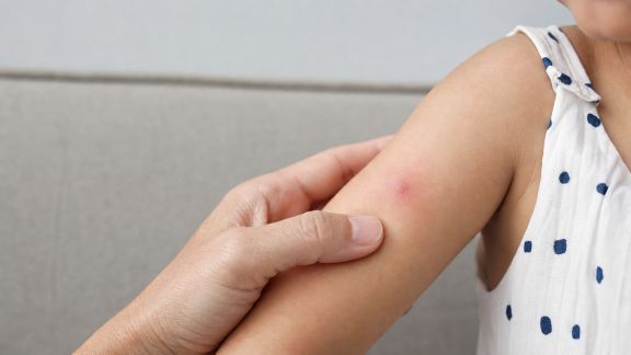Ce qu’il faut savoir sur les piqûres d’insectes chez les enfants et les bons réflexes à adopter